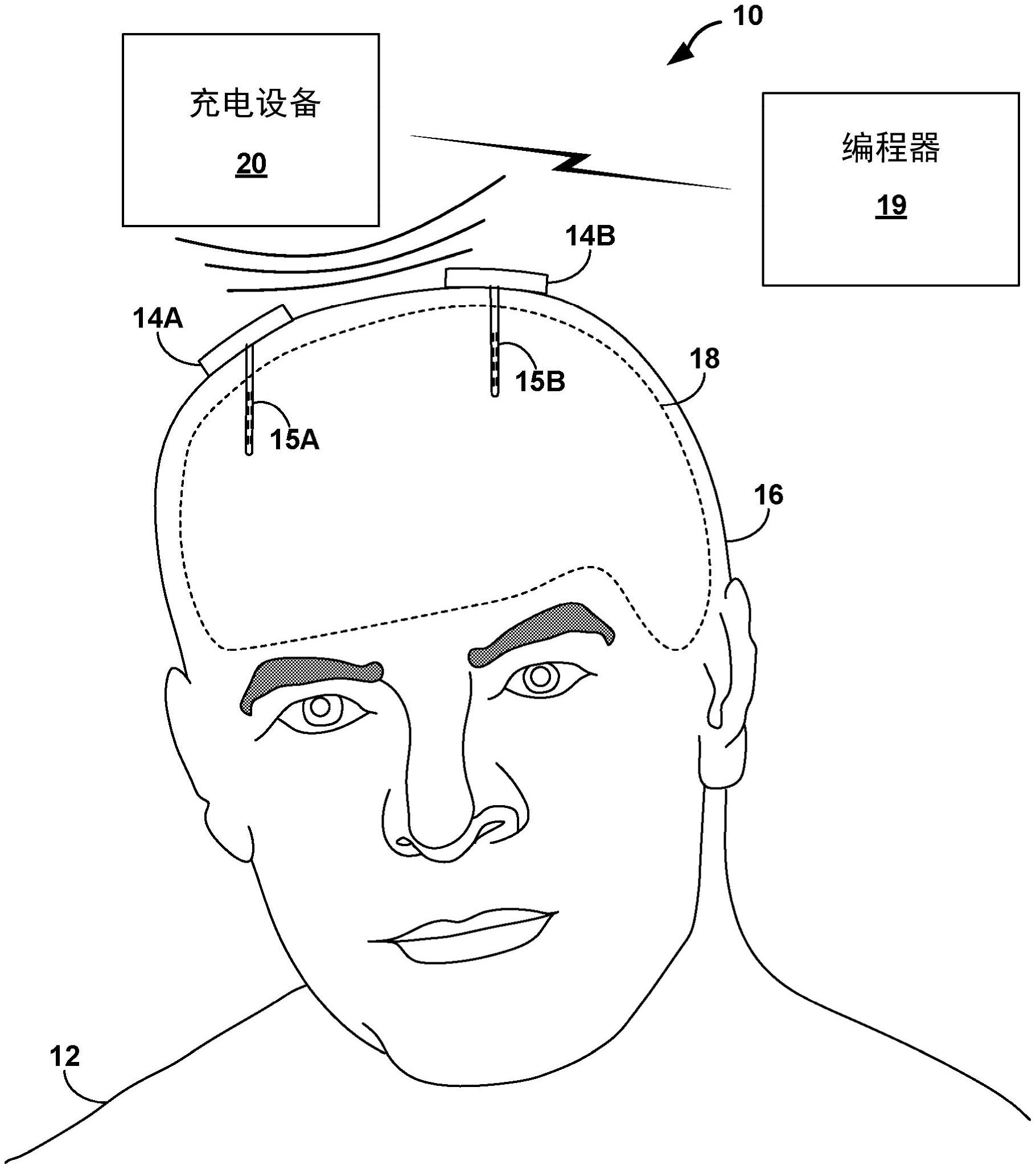 韩过去十年医疗设备专利申请激增42%