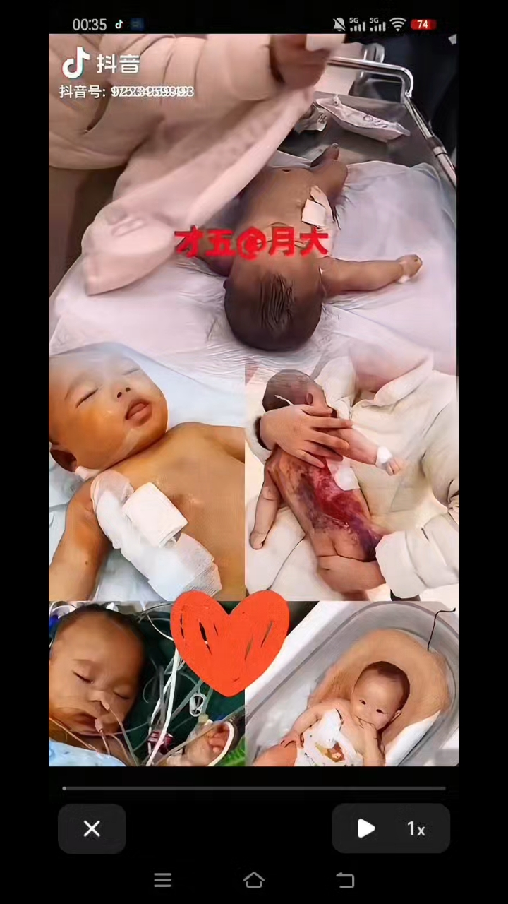 关注“宁波小洛熙”事件的网友 涌进了海康威视直播间