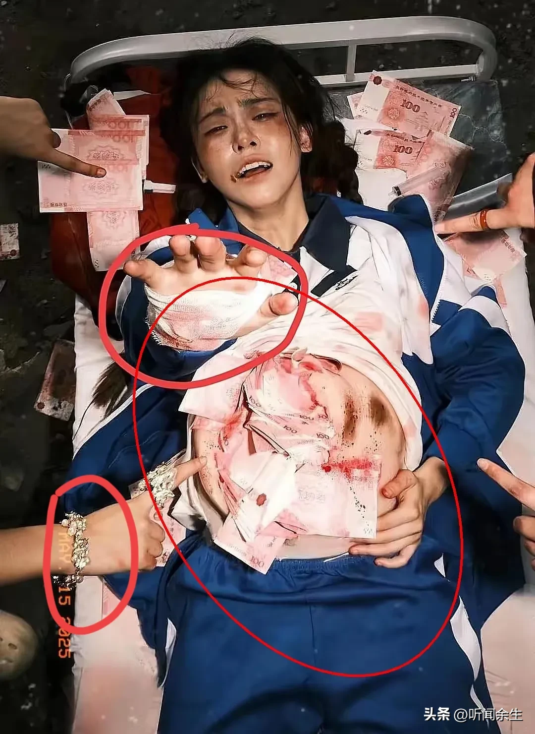 特大走私孕妇血样案涉10万人份样本，血样出境潜藏生物安全风险